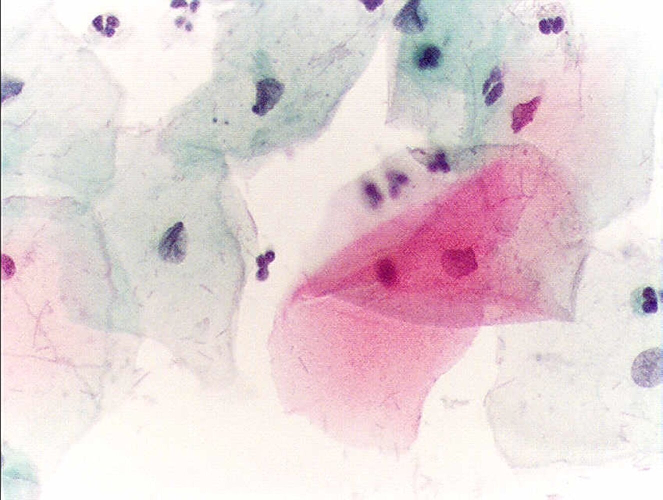 Pap smear (normal findings)