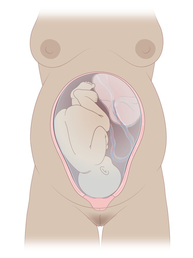 Cephalic presentation (right occiput anterior)