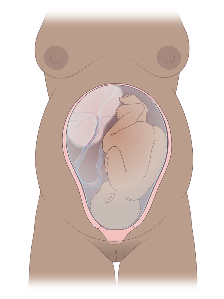 Cephalic presentation (left occiput anterior)