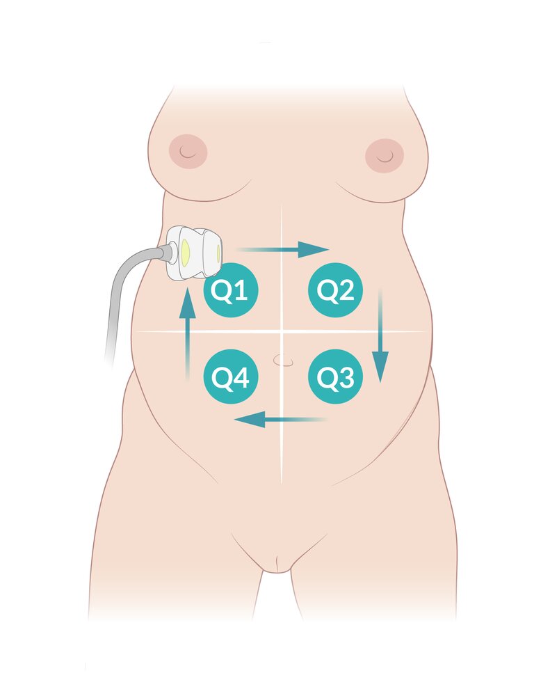 Amniotic fluid index measurement