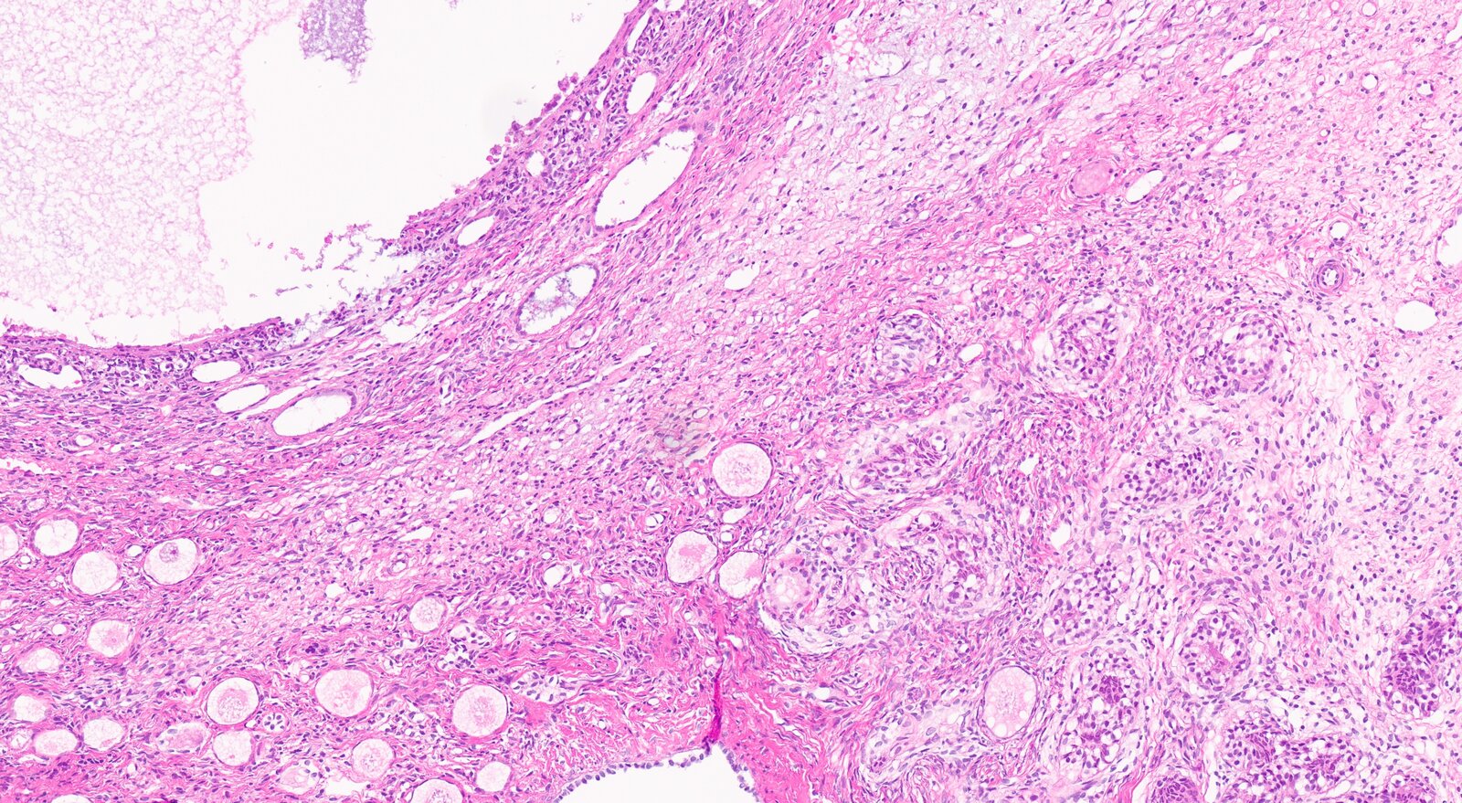 Ovotestis