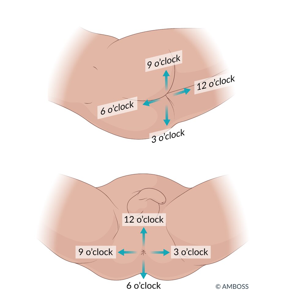Lithotomy and left lateral positions