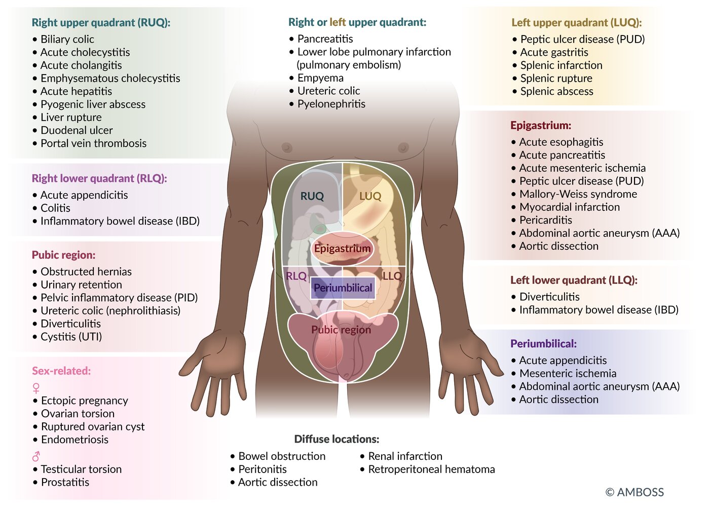 Differential diagnoses of acute abdomen by region