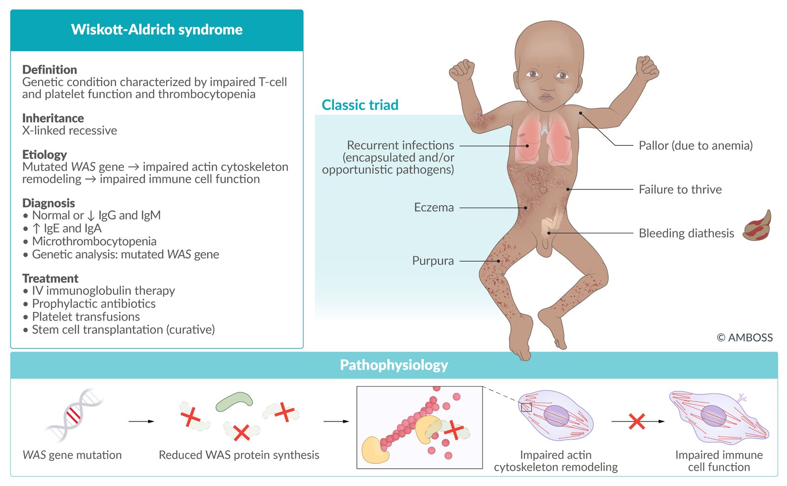 Wiskott-Aldrich syndrome