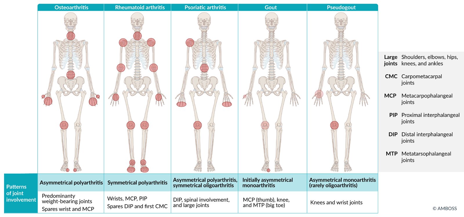 Distribution of joint diseases