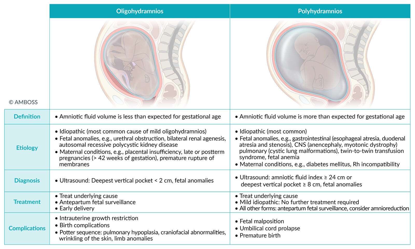 Oligohydramnios vs. polyhydramnios
