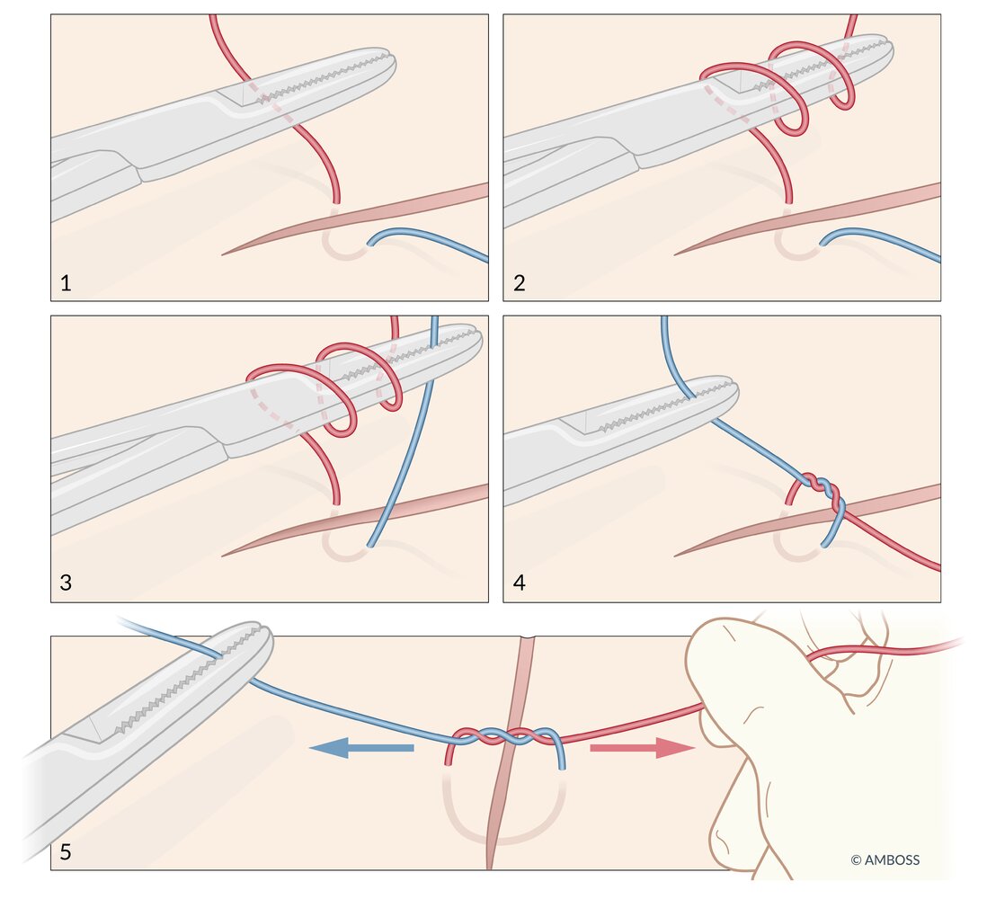 Instrument Tie