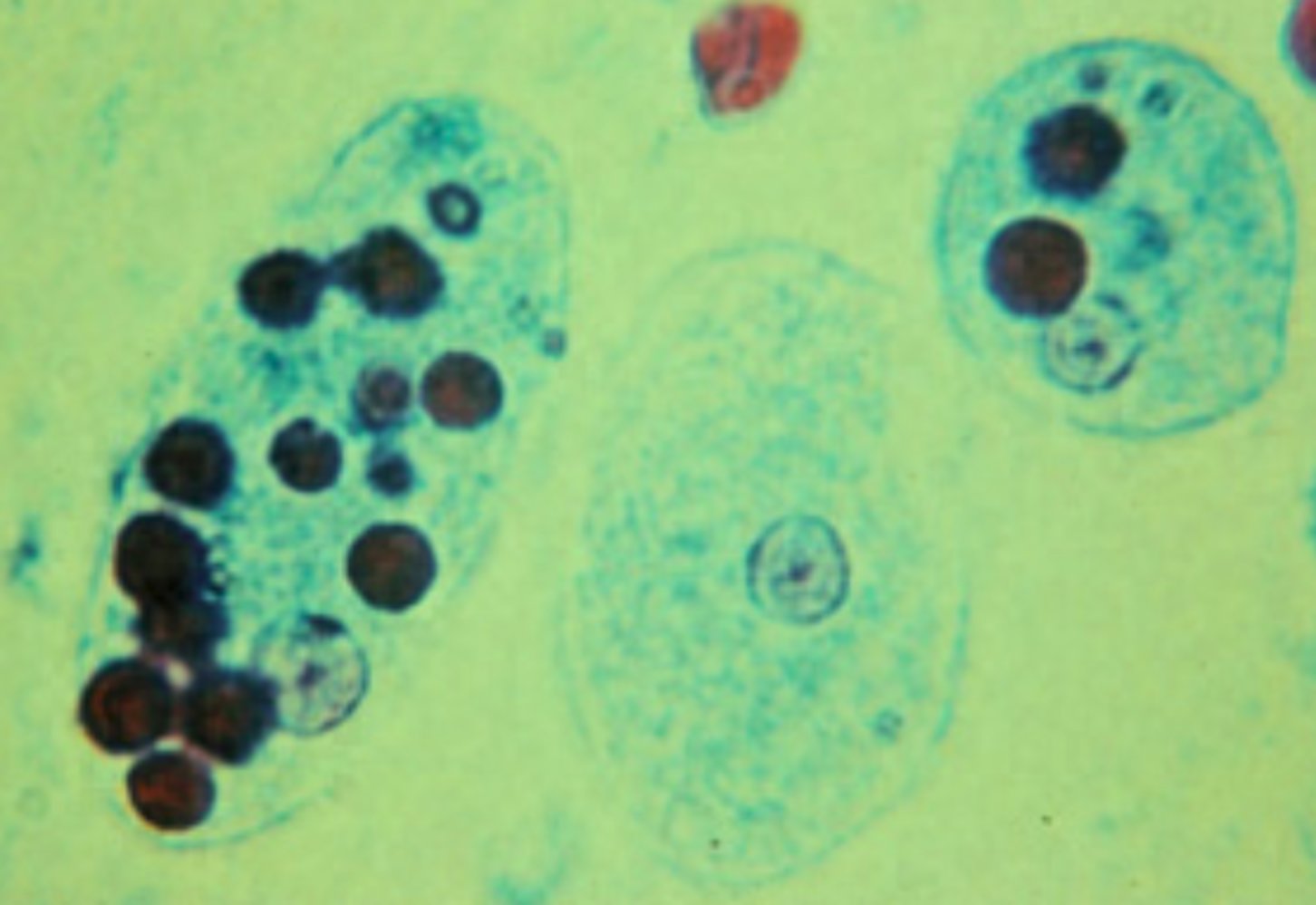 Entamoeba histolytica trophozoites