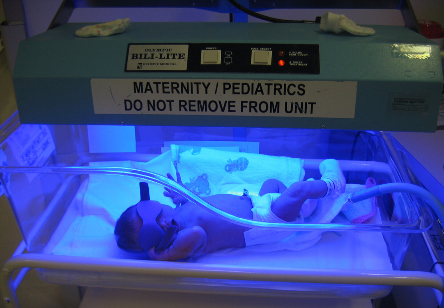 Neonatal phototherapy