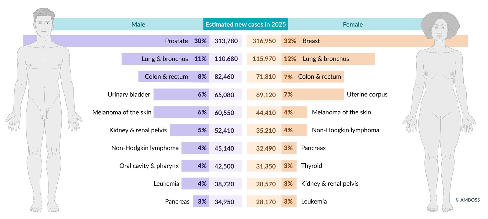 Incidence of cancers in the US (2025 estimates)