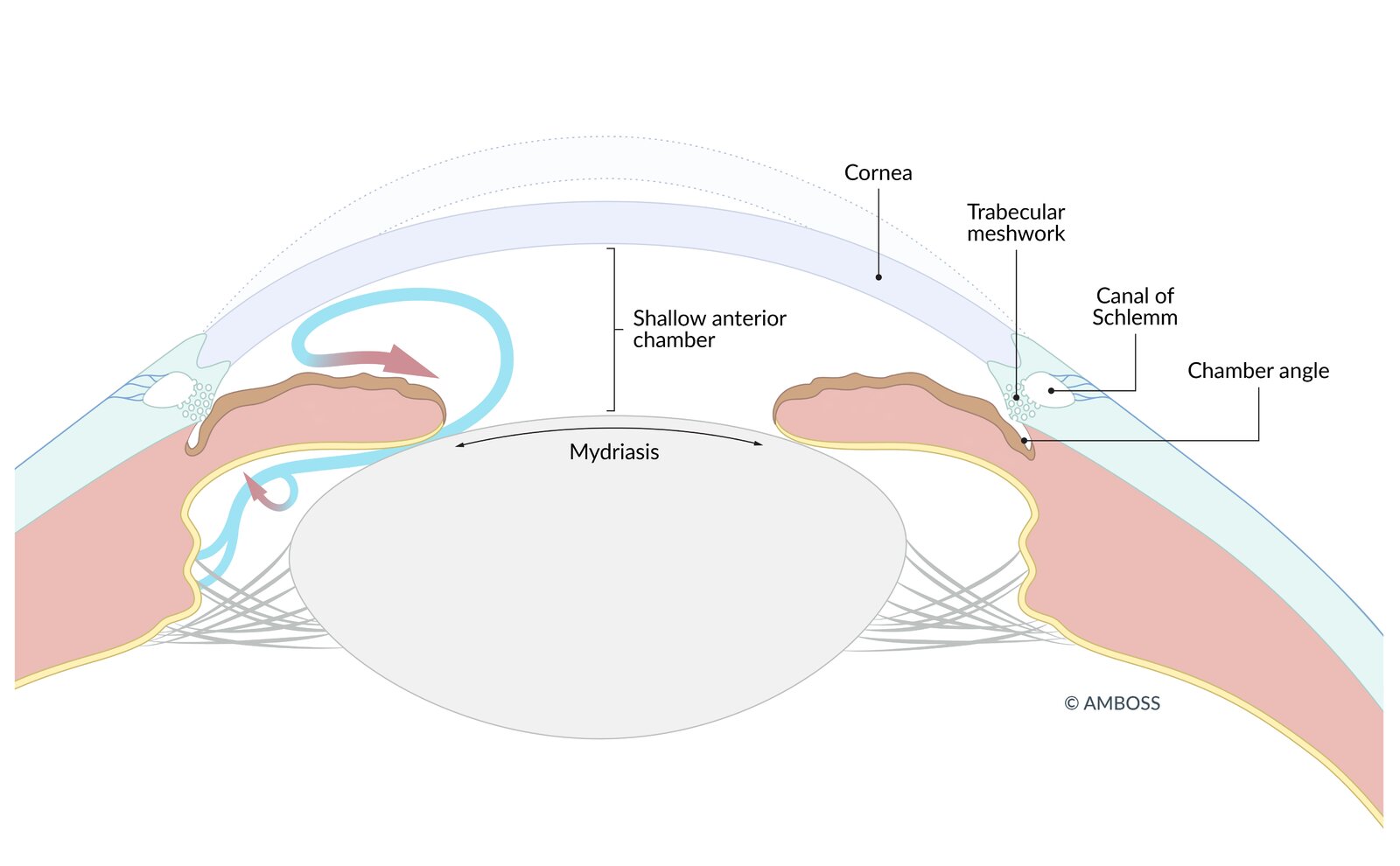 Mechanism of primary angle-closure