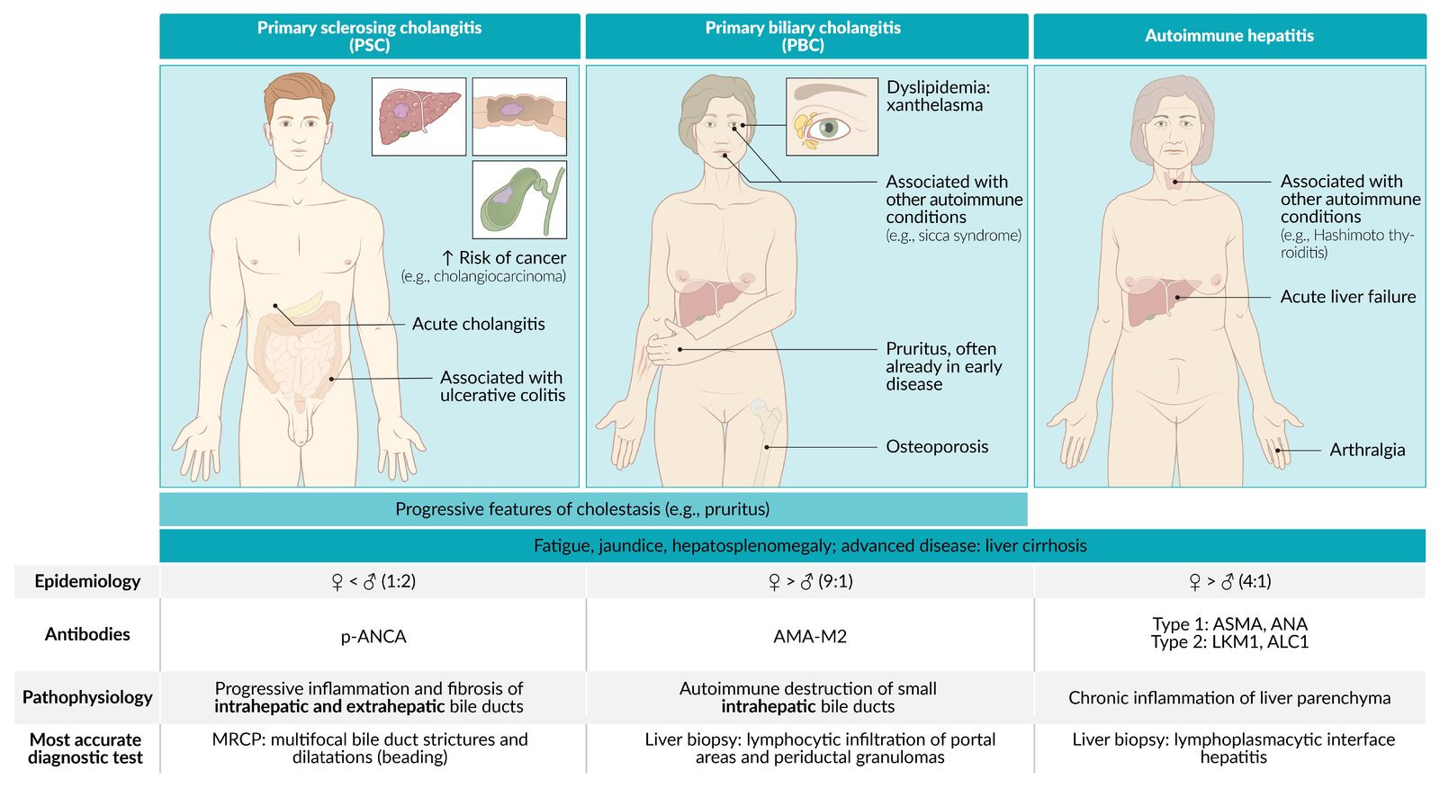 Overview of PSC, PBC, and autoimmune hepatitis