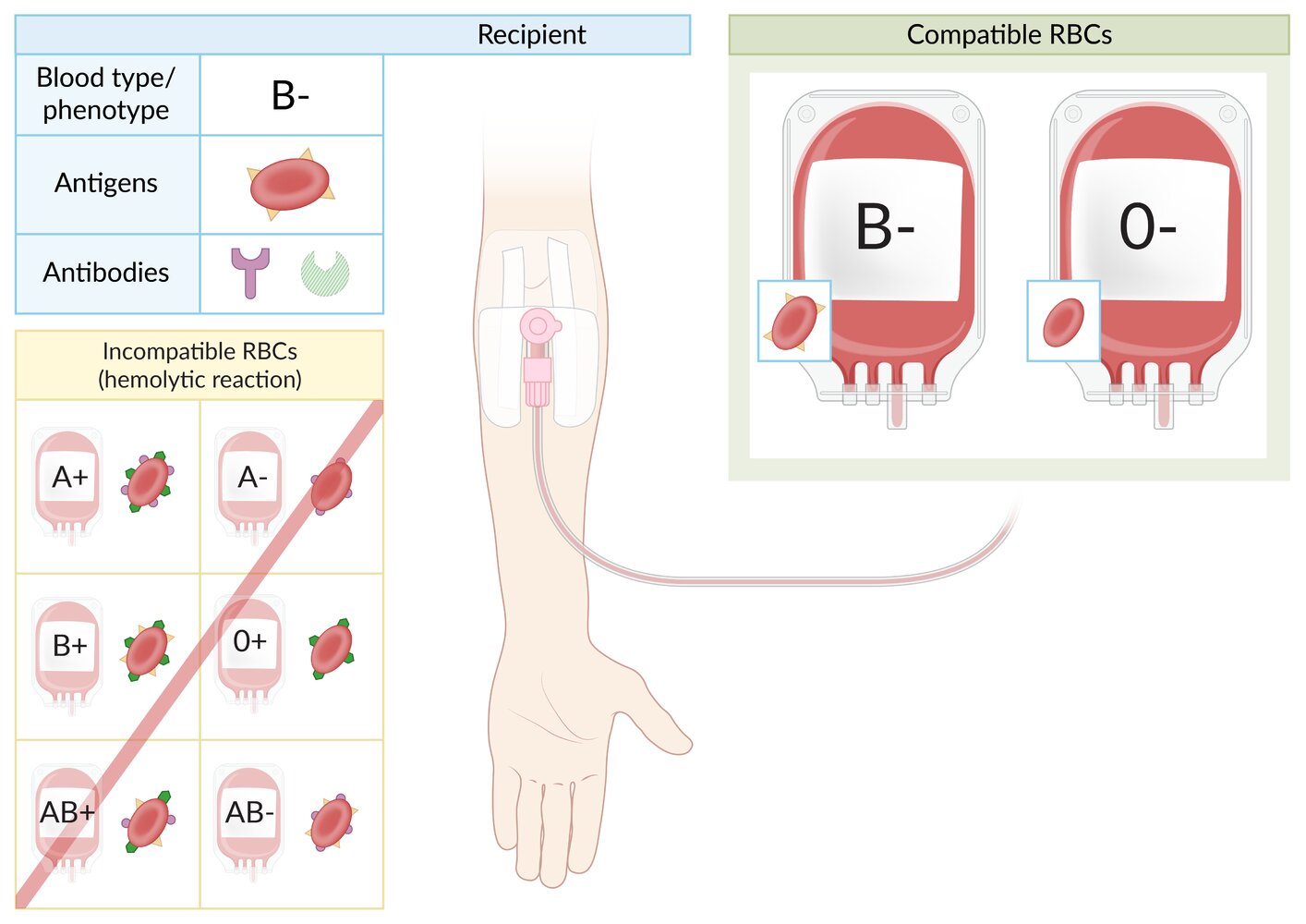 Blood type B- RBC transfusion compatibility