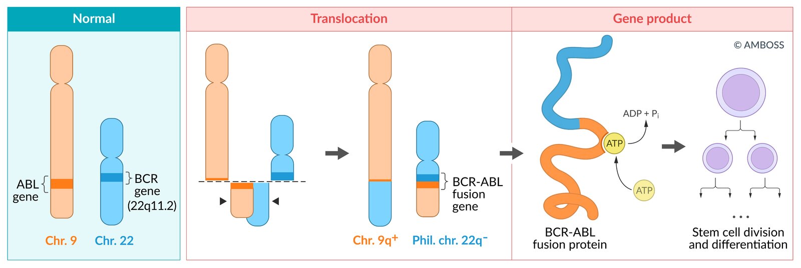 Philadelphia chromosome and pathophysiological consequences