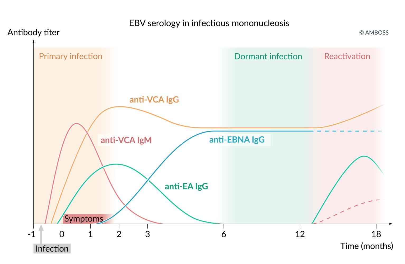 EBV serology in infectious mononucleosis