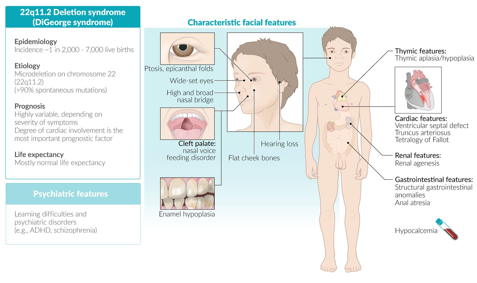 DiGeorge syndrome (22q11.2 deletion syndrome) fact sheet