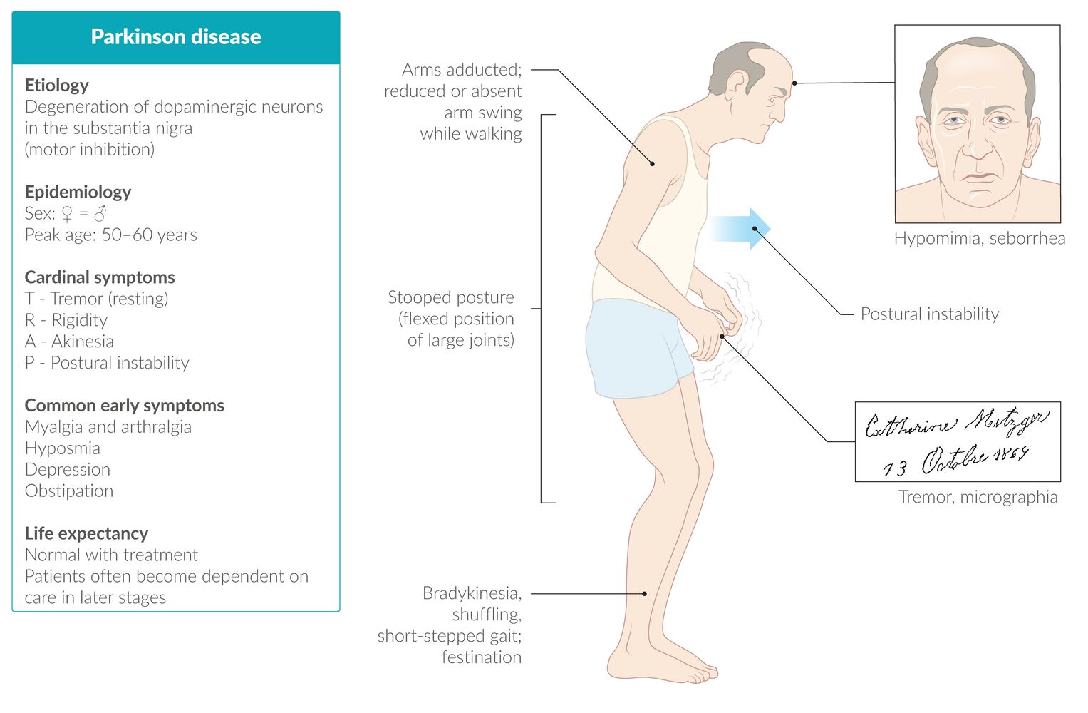 Parkinson disease fact sheet