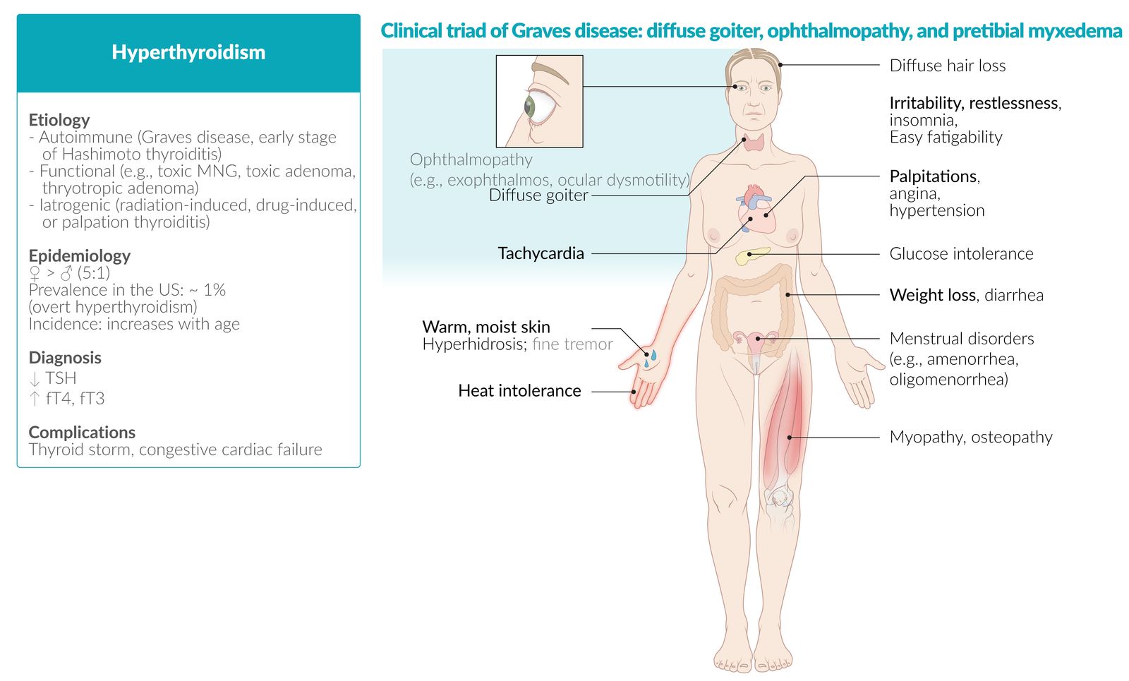 Hyperthyroidism fact sheet