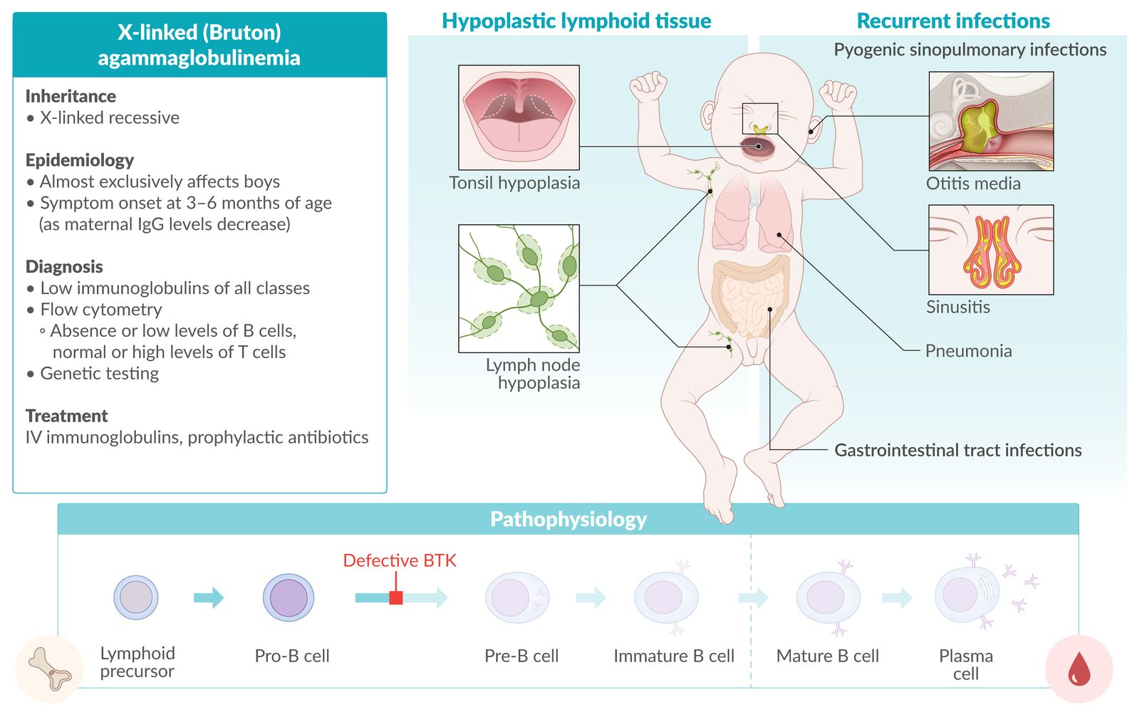 Bruton agammaglobulinemia fact sheet