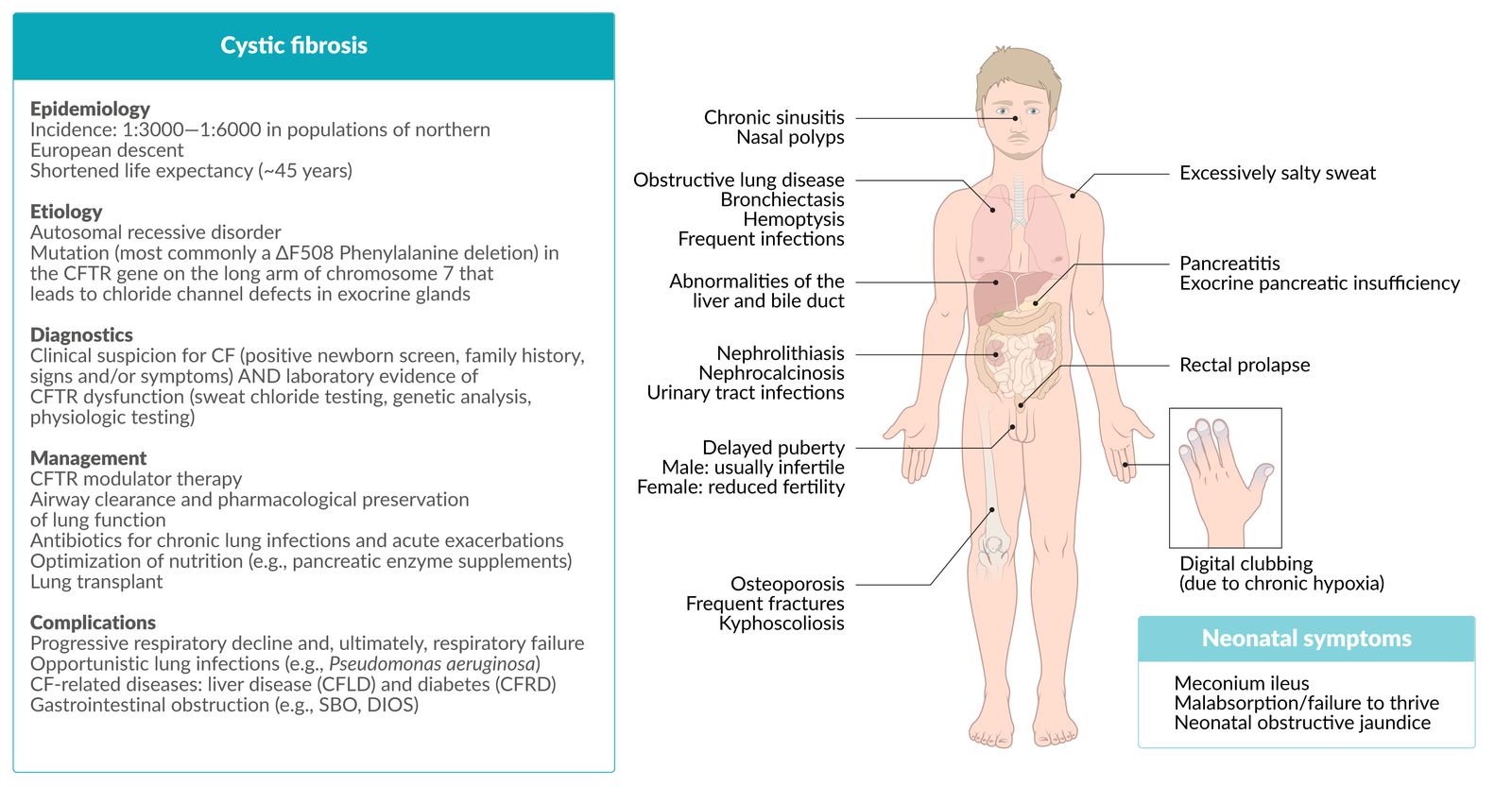 Cystic fibrosis fact sheet