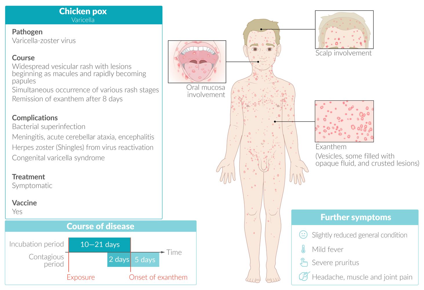 Chickenpox fact sheet