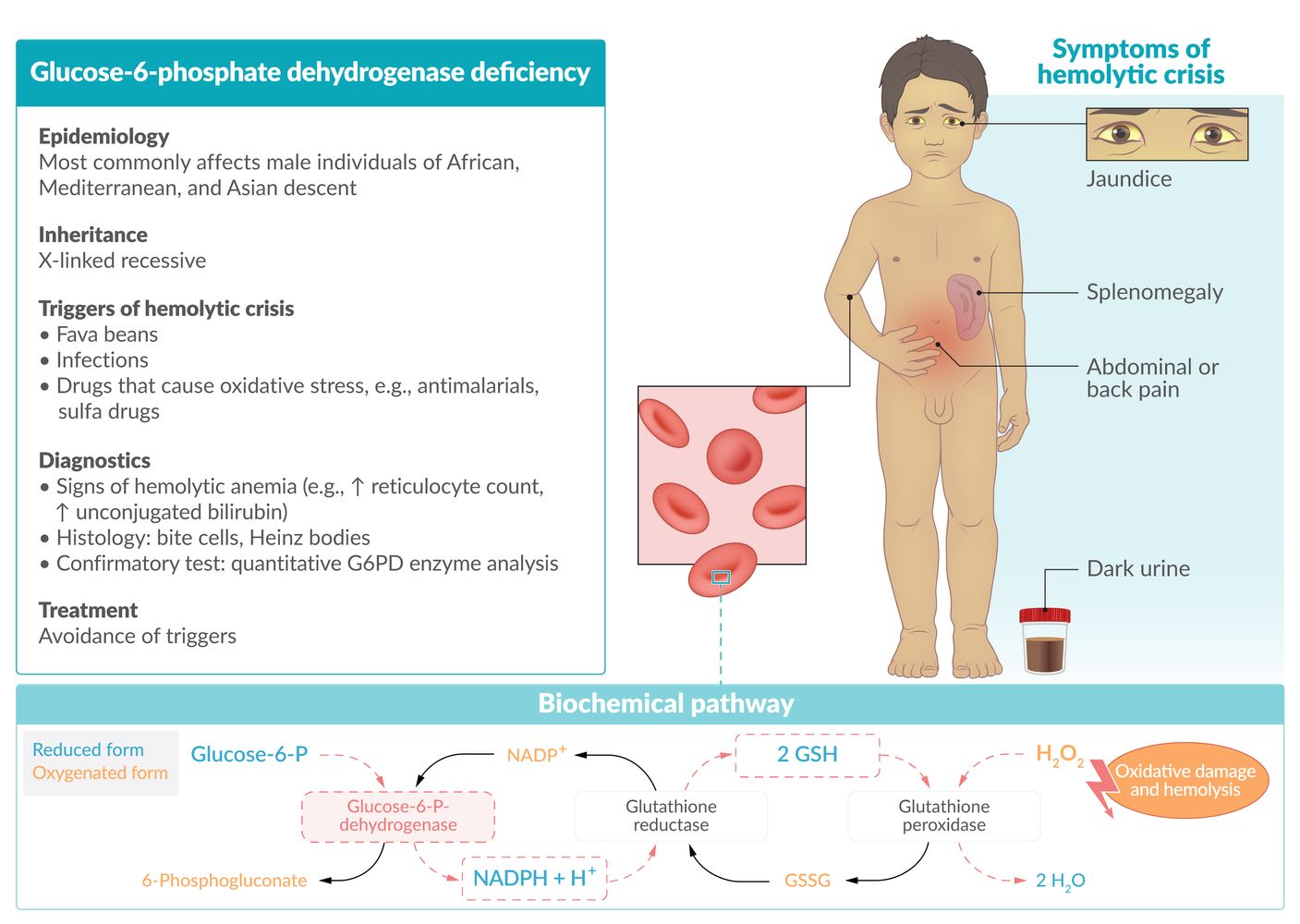 Glucose-6-phosphate dehydrogenase (G6PD) deficiency fact sheet