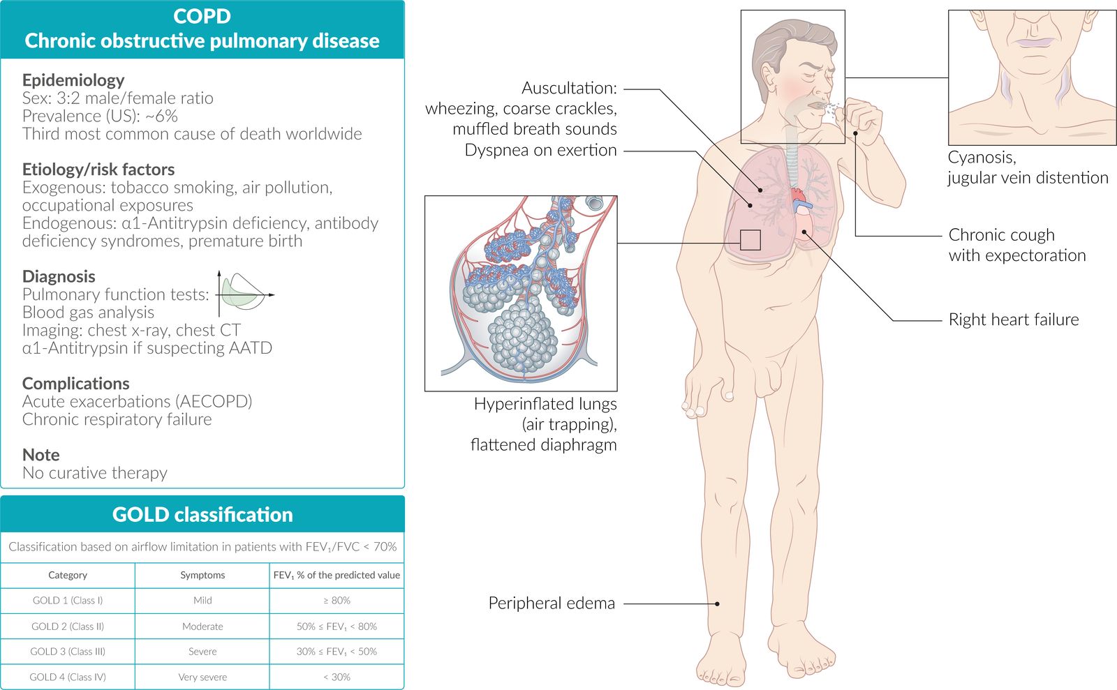 COPD fact sheet
