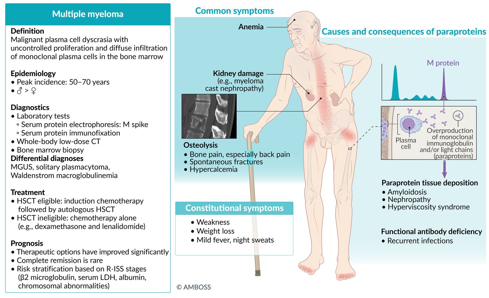 Multiple myeloma fact sheet