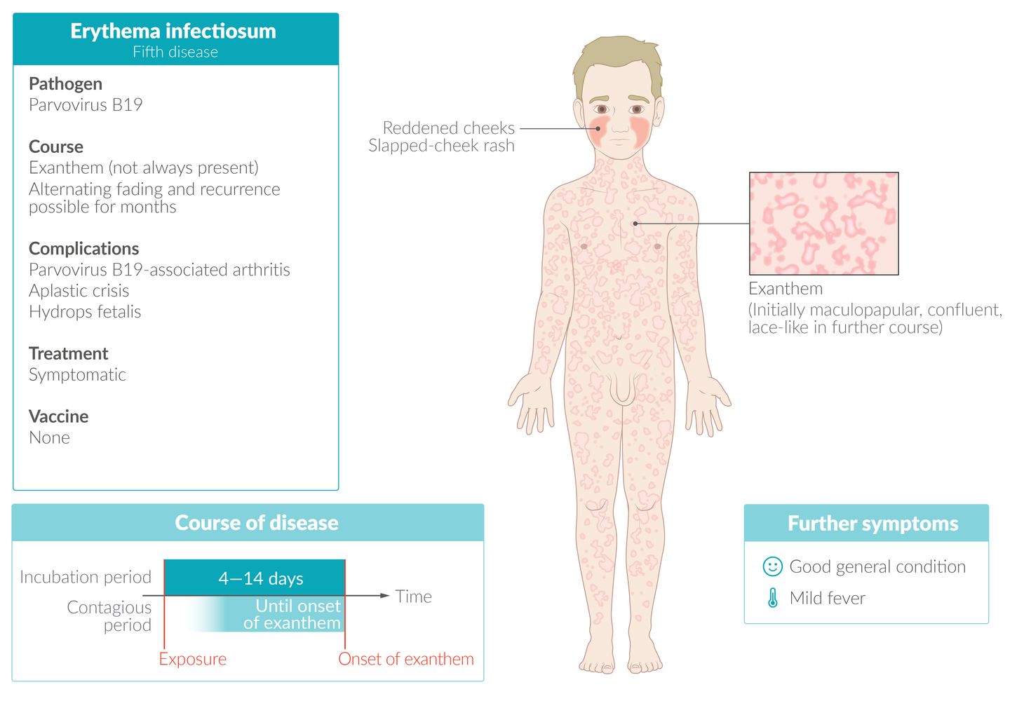Erythema infectiosum (fifth disease) fact sheet