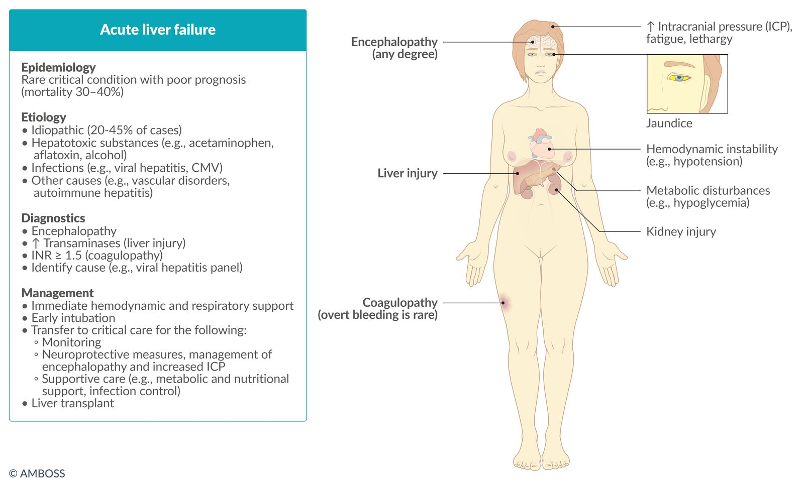 Acute liver failure fact sheet