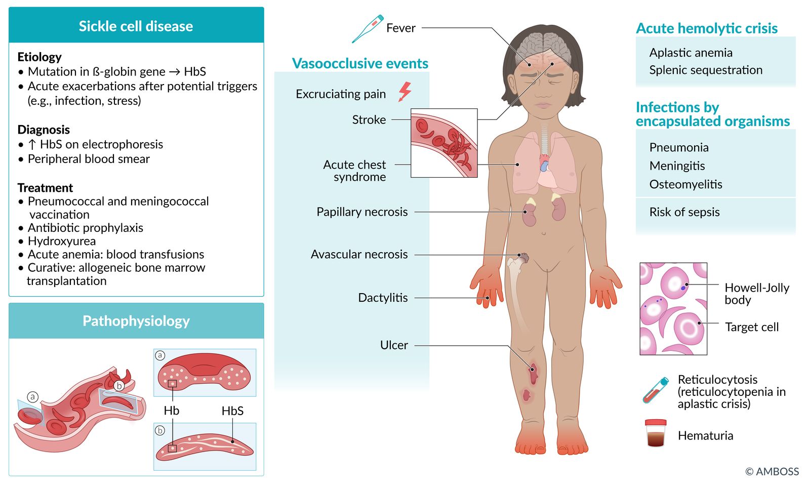 Sickle cell fact sheet