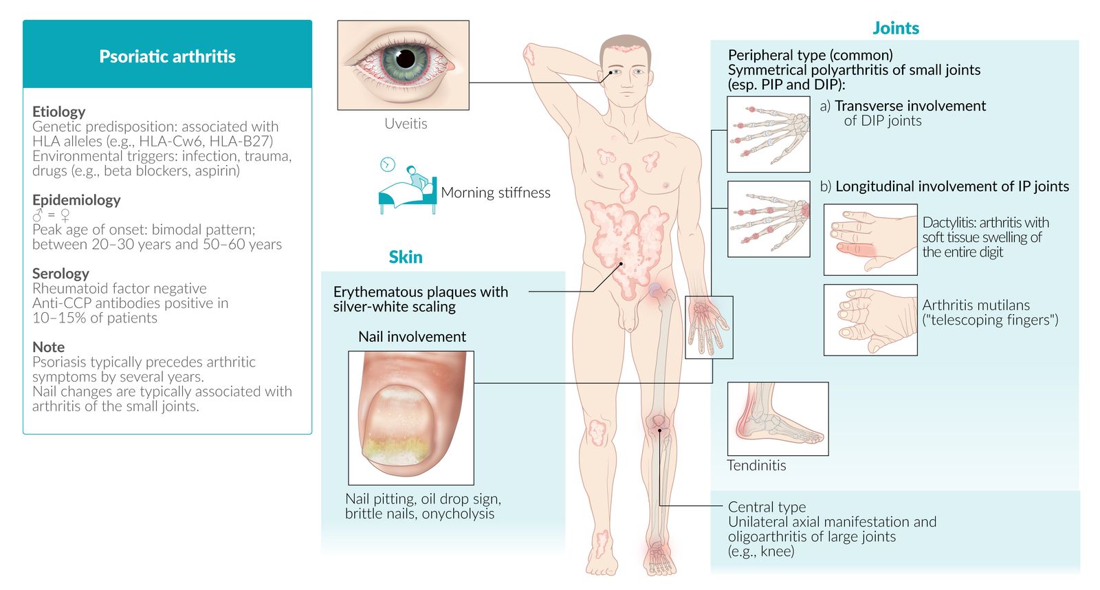 Psoriatic arthritis fact sheet