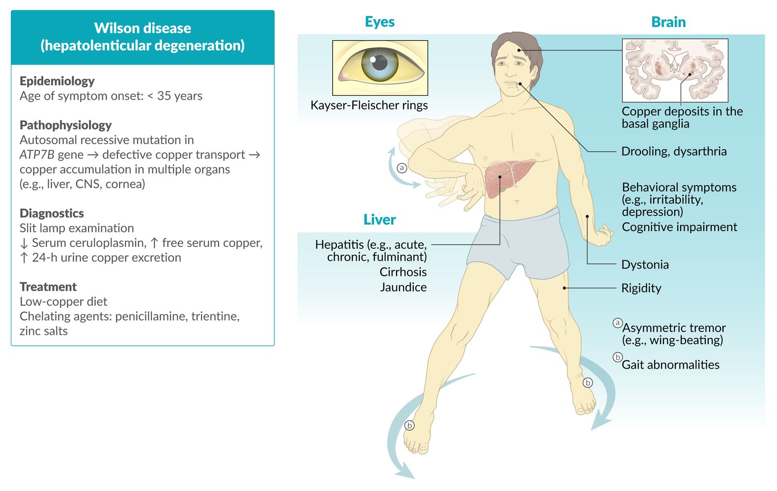 Wilson disease fact sheet