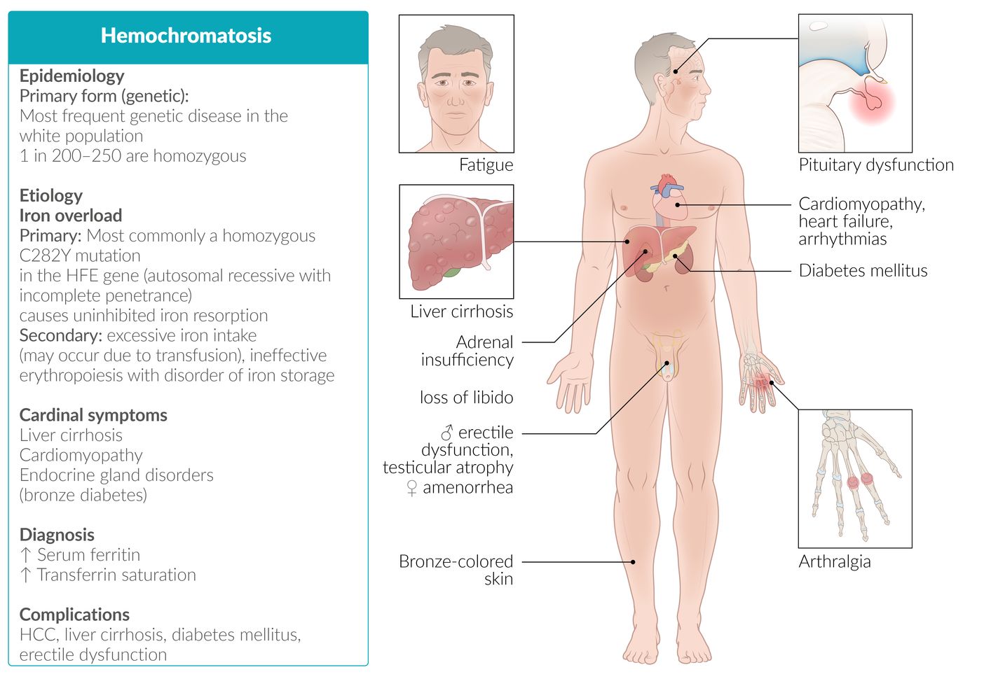 Hemochromatosis fact sheet