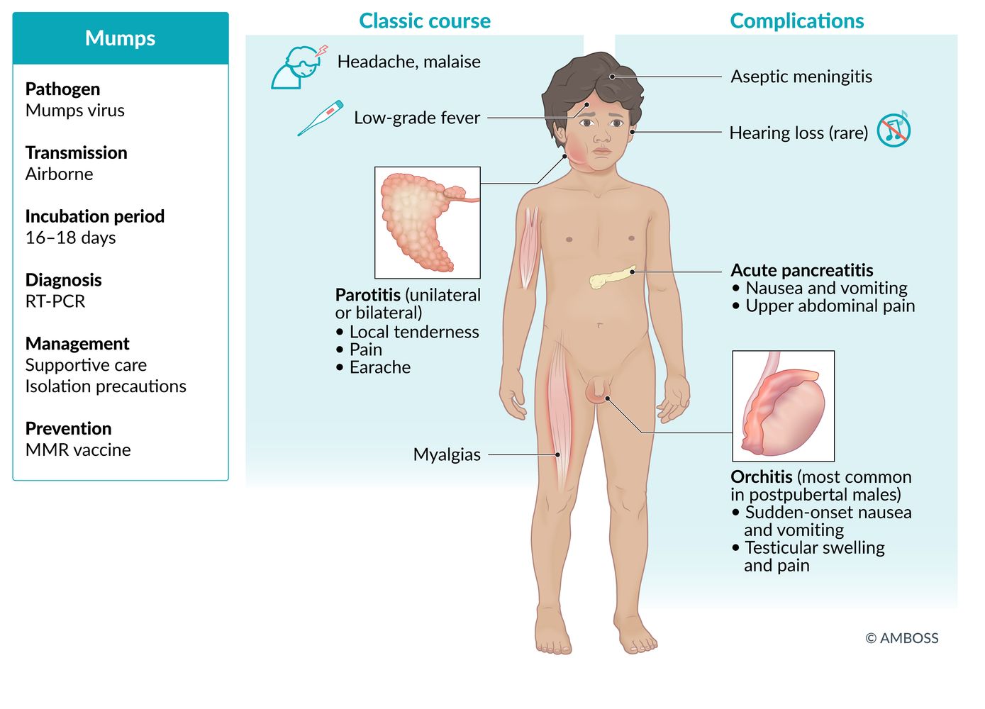 Mumps fact sheet