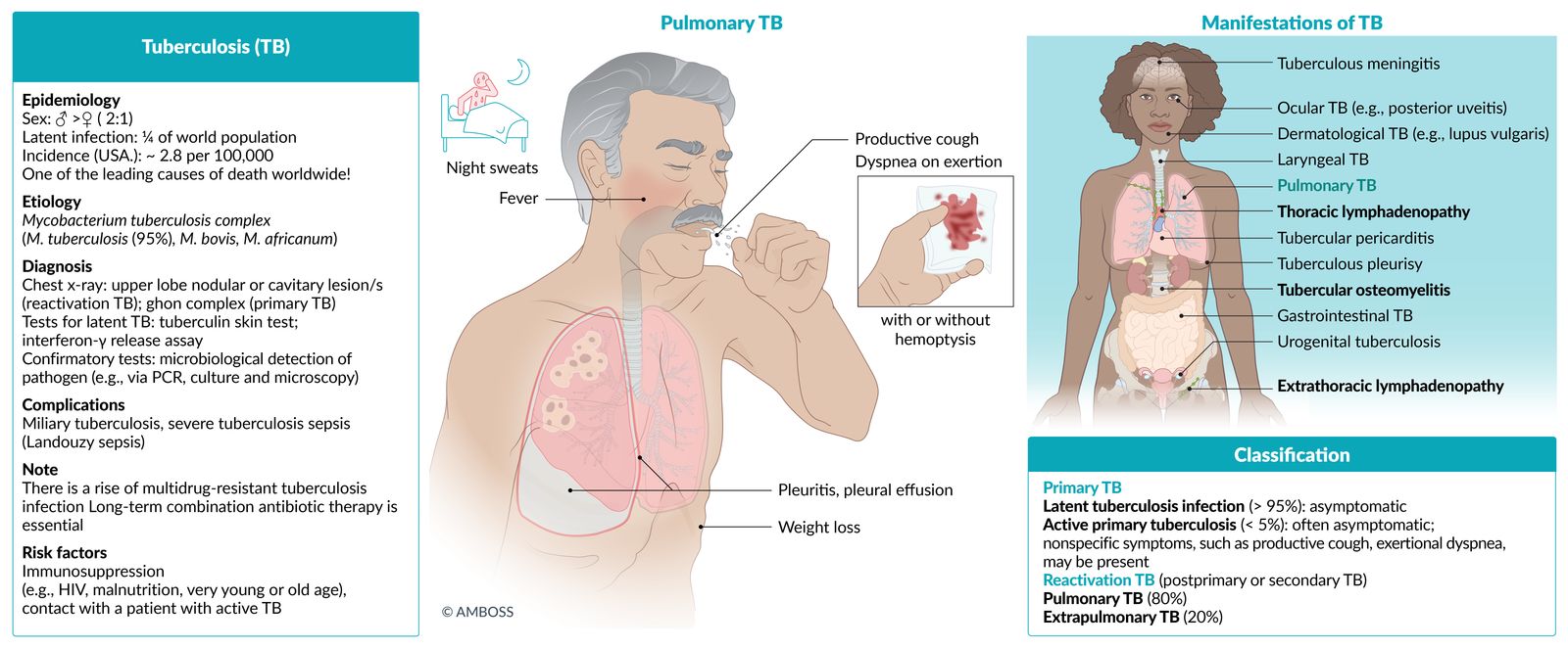 Tuberculosis fact sheet