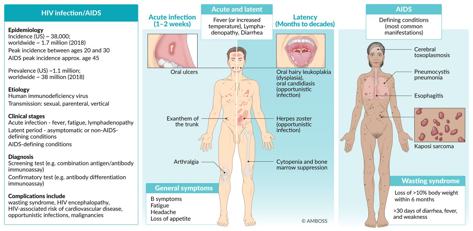 HIV/AIDS fact sheet