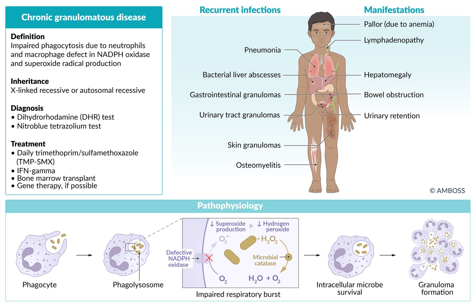 Chronic granulomatous disease fact sheet