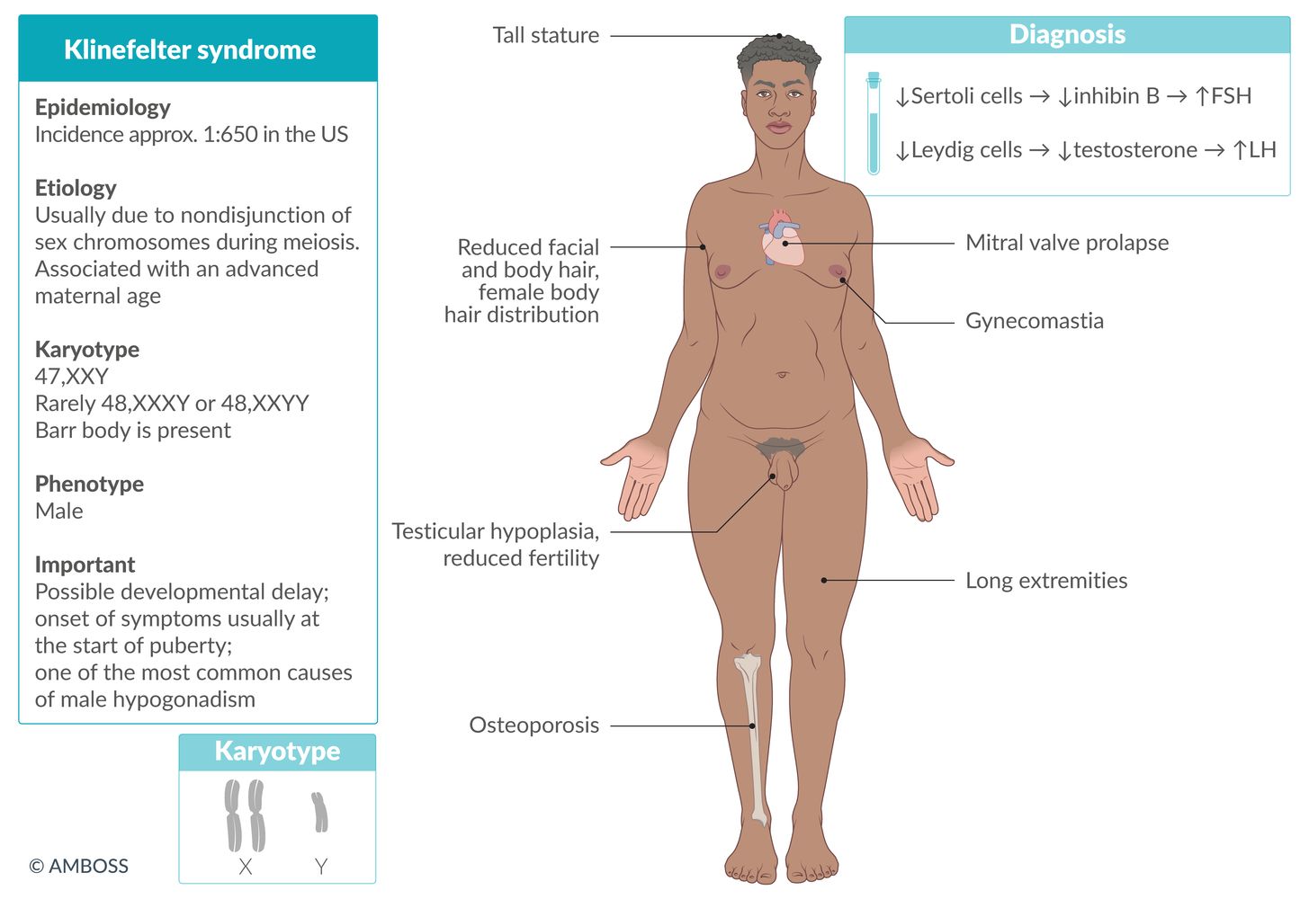 Klinefelter syndrome fact sheet