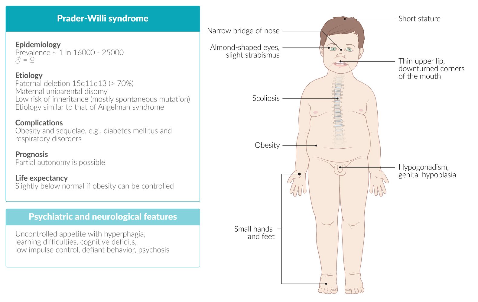 Prader-Willi syndrome fact sheet