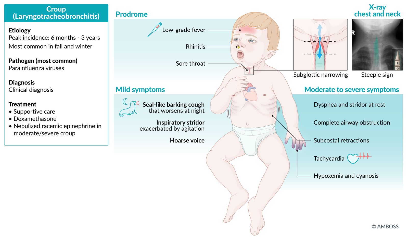 Croup factsheet