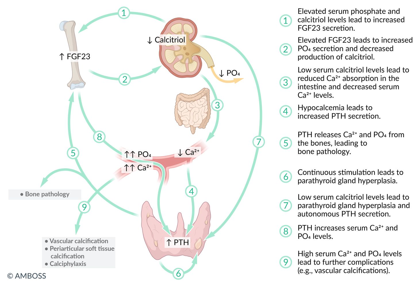 Pathophysiology of chronic kidney disease-mineral and bone disorder (CKD-MBD)