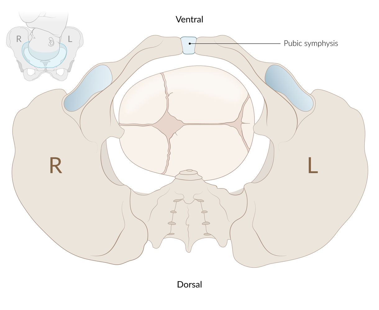 Plane of the pelvic inlet: left occiput transverse position