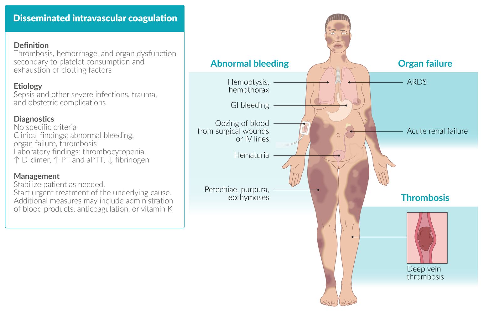 Disseminated intravascular coagulation fact sheet