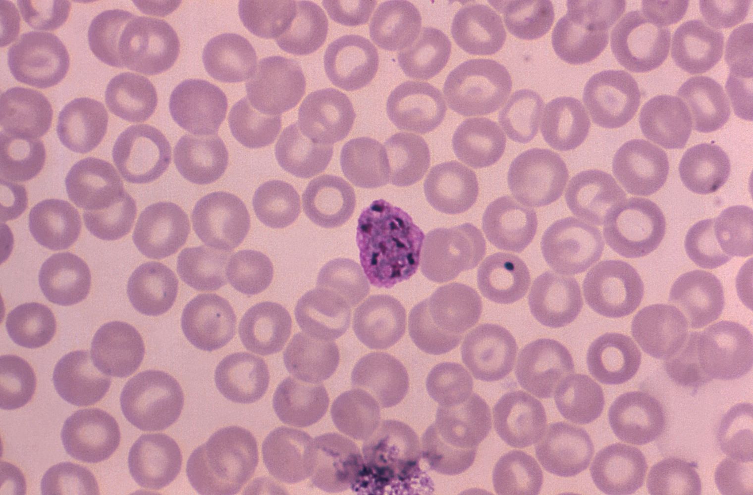 Red cell schizont (P. vivax)