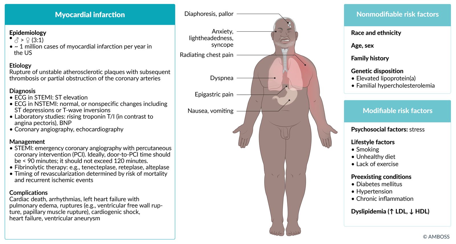 Myocardial infarction fact sheet