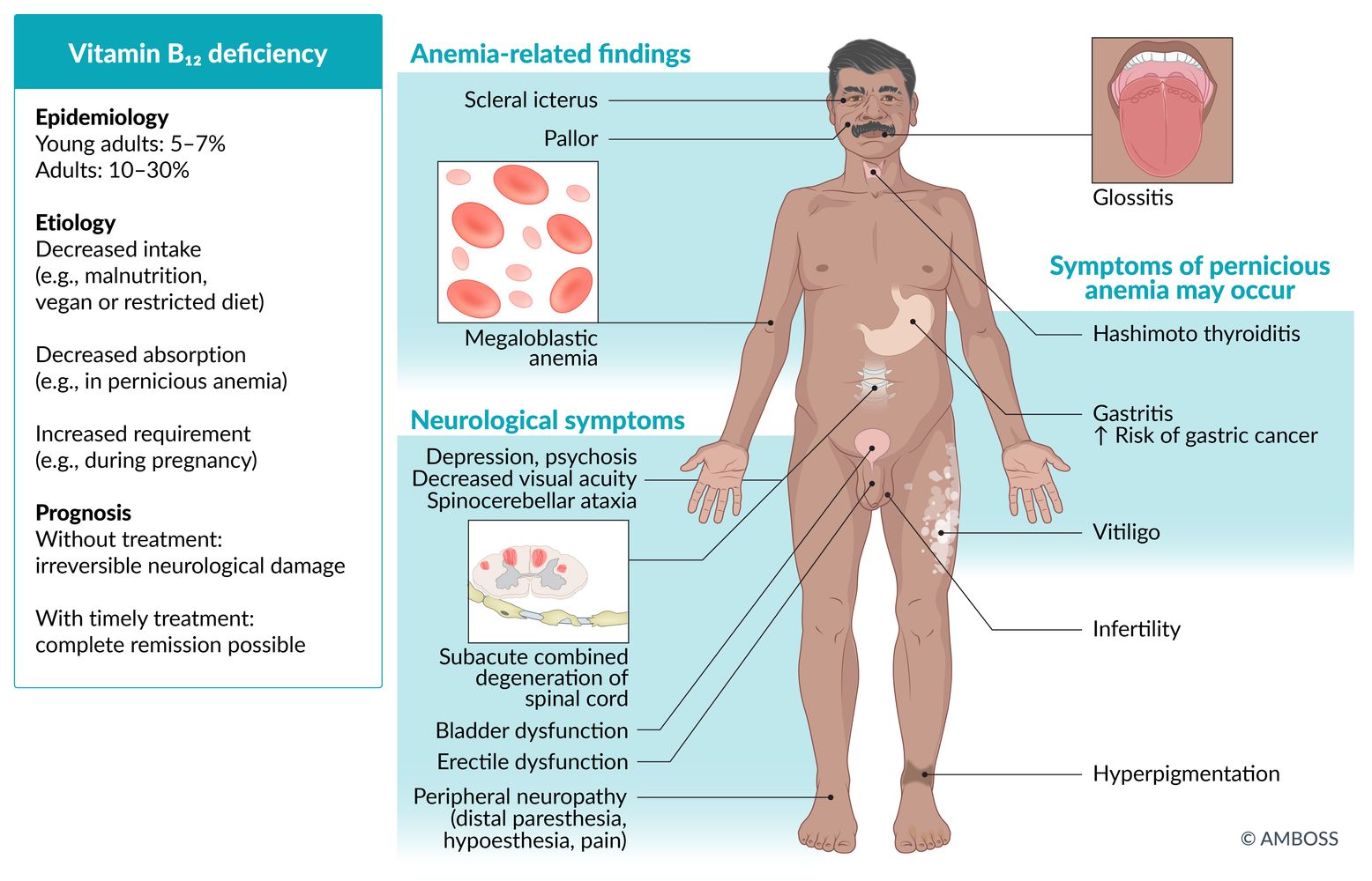 Vitamin B12 deficiency fact sheet